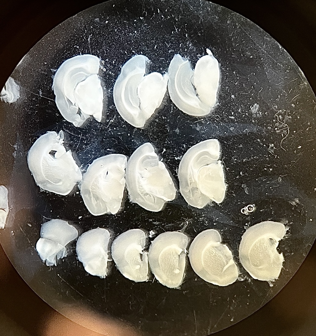 mouse brain dissected by Anne